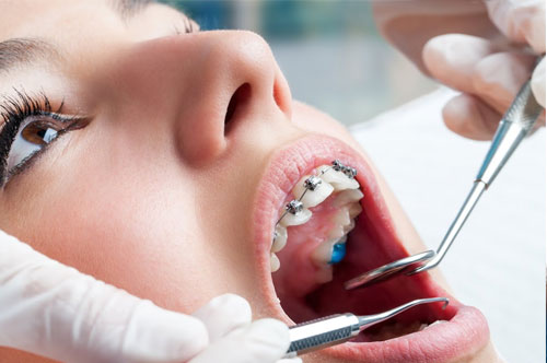 Boost Your Oral Health With Orthodontics!
