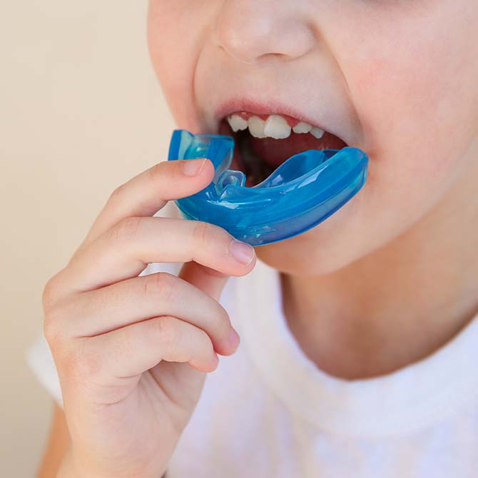 Custom Mouthguards